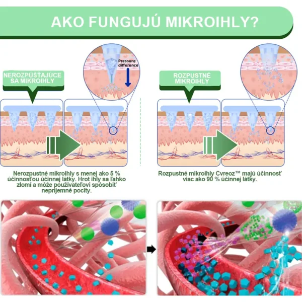 Voilaist® SMGT-GLP-1 Nano Mikroneedlová Náplasť