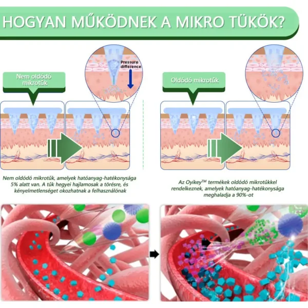 Voilaist® SMGT-GLP-1 Nano Mikrotűs Tapasz