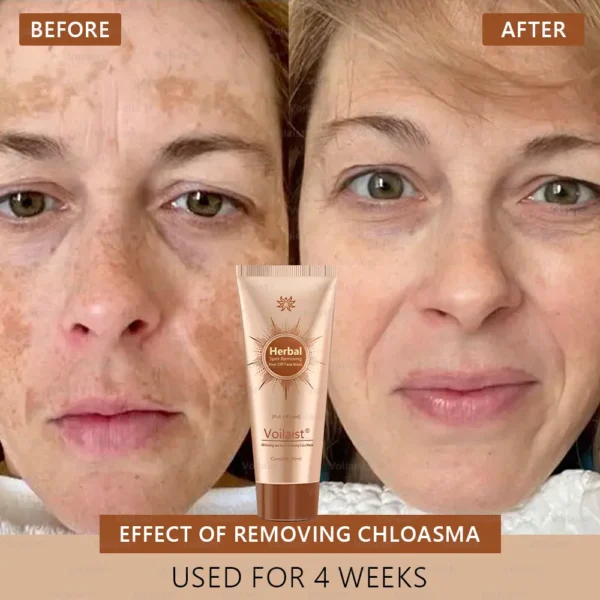 Voilaist® Whitening and Spot-Removing Face Mask