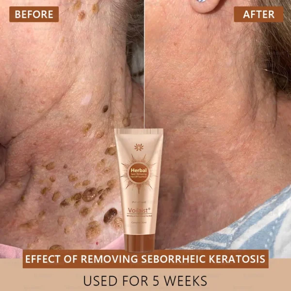 Voilaist® Whitening and Spot-Removing Face Mask