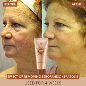 Voilaist® Whitening and Spot-Removing Face Mask