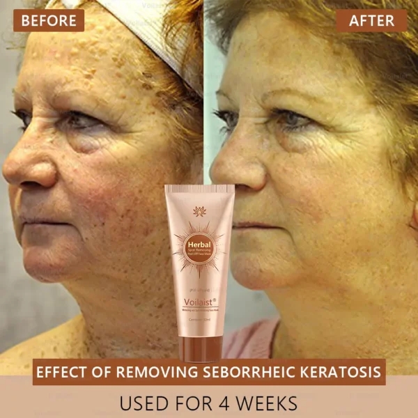 Voilaist® Whitening and Spot-Removing Face Mask