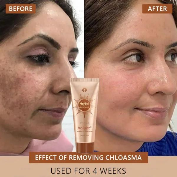 Voilaist® Whitening and Spot-Removing Face Mask