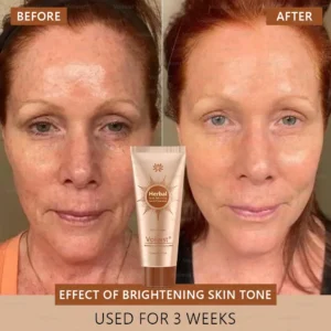 Voilaist® Whitening and Spot-Removing Face Mask