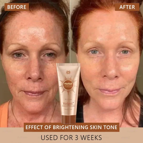 Voilaist® Whitening and Spot-Removing Face Mask