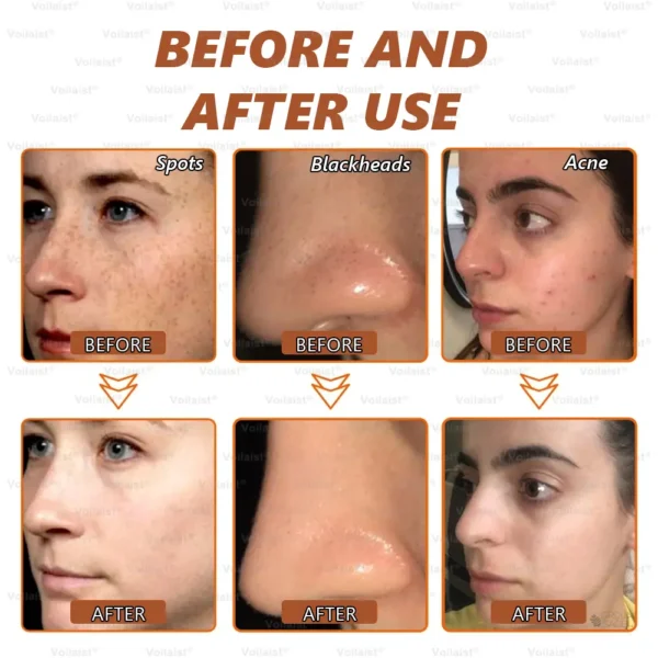Voilaist® Whitening and Spot-Removing Face Mask