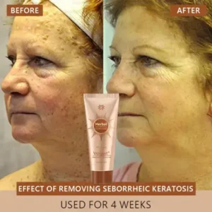 Voilaist® Whitening and Spot-Removing Face Mask