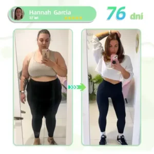 Voilaist® SMGT-GLP-1 Nano Microneedlová Náplast