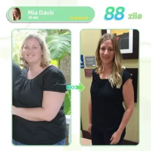 Voilaist® plasture nano cu microace SMGT-GLP-1