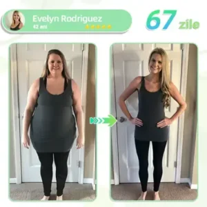 Voilaist® plasture nano cu microace SMGT-GLP-1