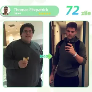 Voilaist® plasture nano cu microace SMGT-GLP-1