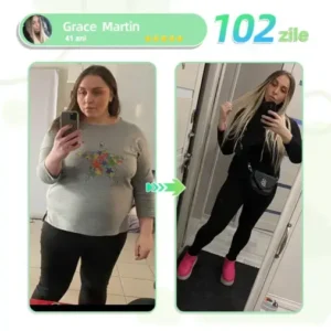 Voilaist® plasture nano cu microace SMGT-GLP-1