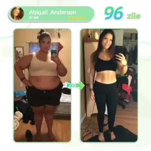 Voilaist® plasture nano cu microace SMGT-GLP-1